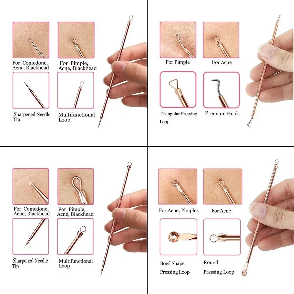 Color: WHITE - 4PCS Stainless Steel Acne Needle Electroplating Colorful Rose Gold Acne Needle Extrusion Blackhead Tool Can Be Customized LOGO