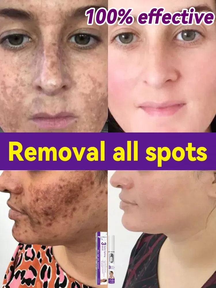 Color: WHITE - H? s? ???? ? s? ?? ??? s???, ?&ldquo