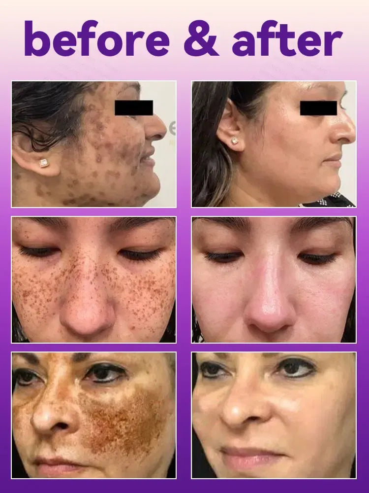 Color: WHITE - H? s? ???? ? s? ?? ??? s???, ?&ldquo