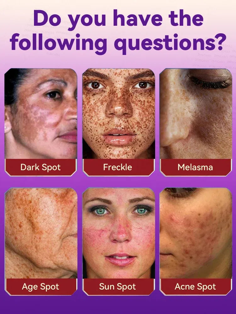 Color: WHITE - H? s? ???? ? s? ?? ??? s???, ?&ldquo